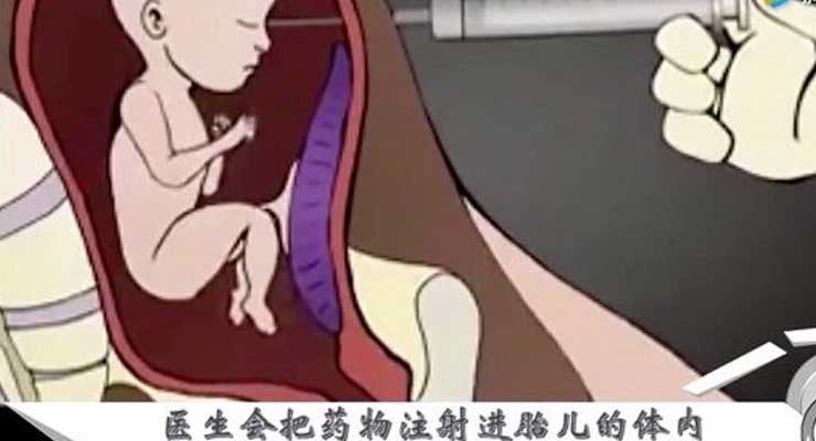 试管婴儿的胚胎质量评估标准