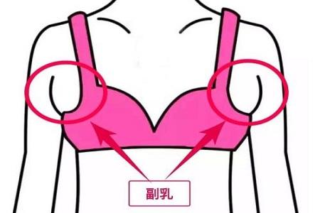 一些有侧乳的妇女会怎样？