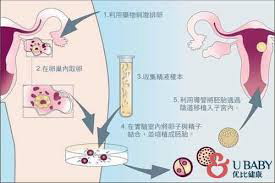 武汉二代试管婴儿包生男孩_武汉皇家医院-输卵管移植后需要考虑的四件事。