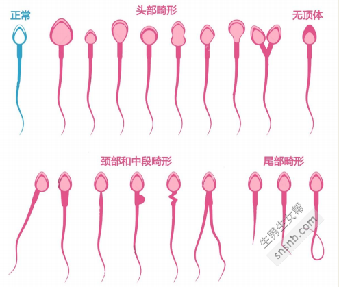 [正常精子常规参考表]精子质量差会影响下一代吗？